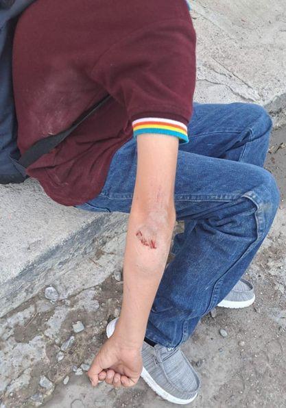 Impacta motocicleta a niño en bici y huye