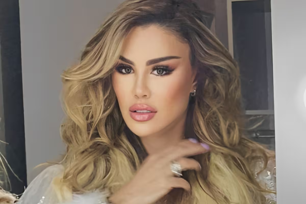 Ninel Conde luce nuevo rostro tras someterse a otro procedimiento estético