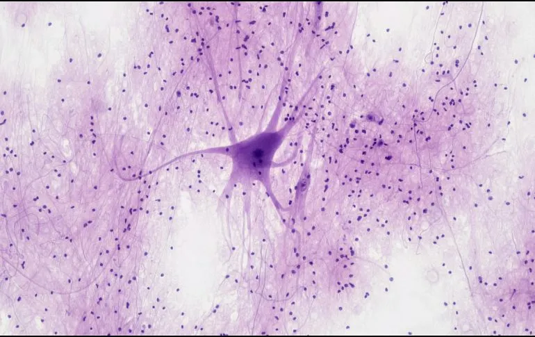 Neuronas a partir de células de la piel para estudiar el alzhéimer