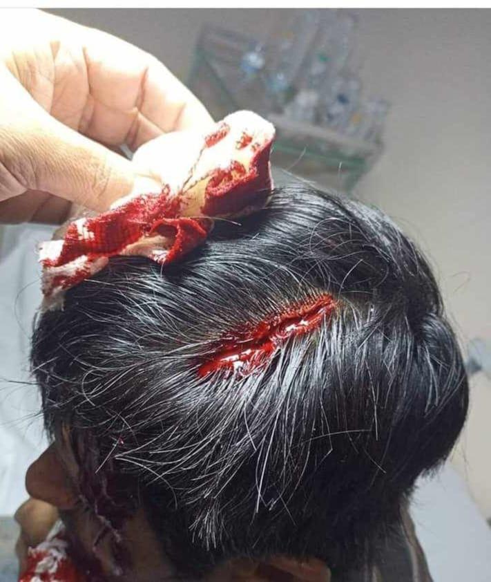 POLICÍA DE LAMADRID LE DA BRUTAL GOLPIZA