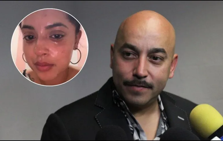Abigail Rivera, hija de Lupillo Rivera, sufre grave accidente en el rostro