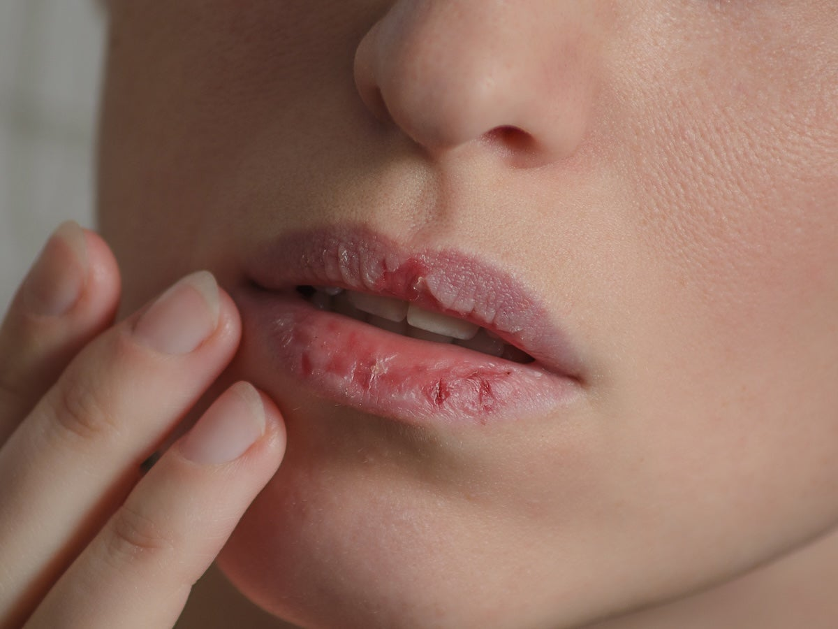 5 causas por las que sientes la boca seca, descubre si afecta a tu salud