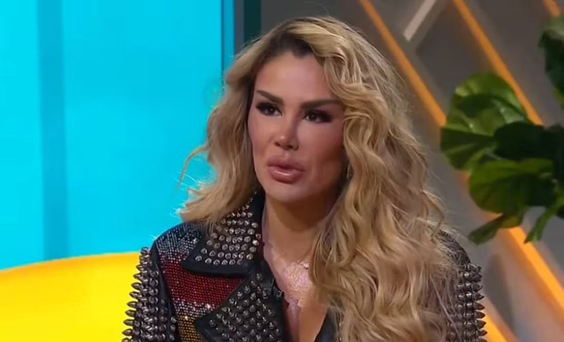 Ninel Conde impacta tras aparecer en programa de tv: «se desfiguro el rostro, tan bonita que era»