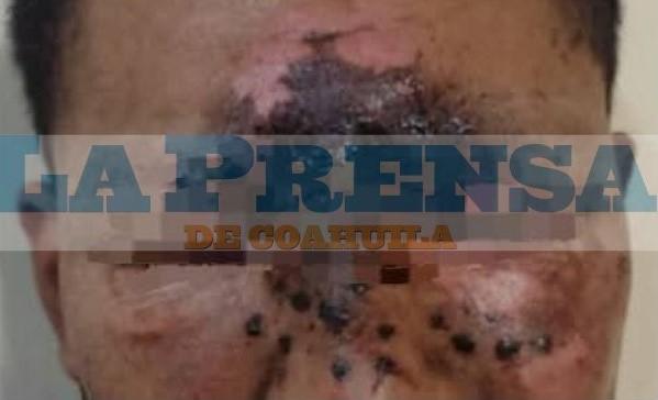 Le explota cohete a padre de familia