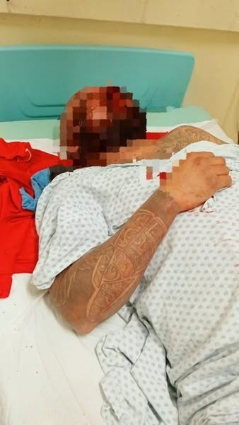 Agreden a hombre; lo abandonan grave