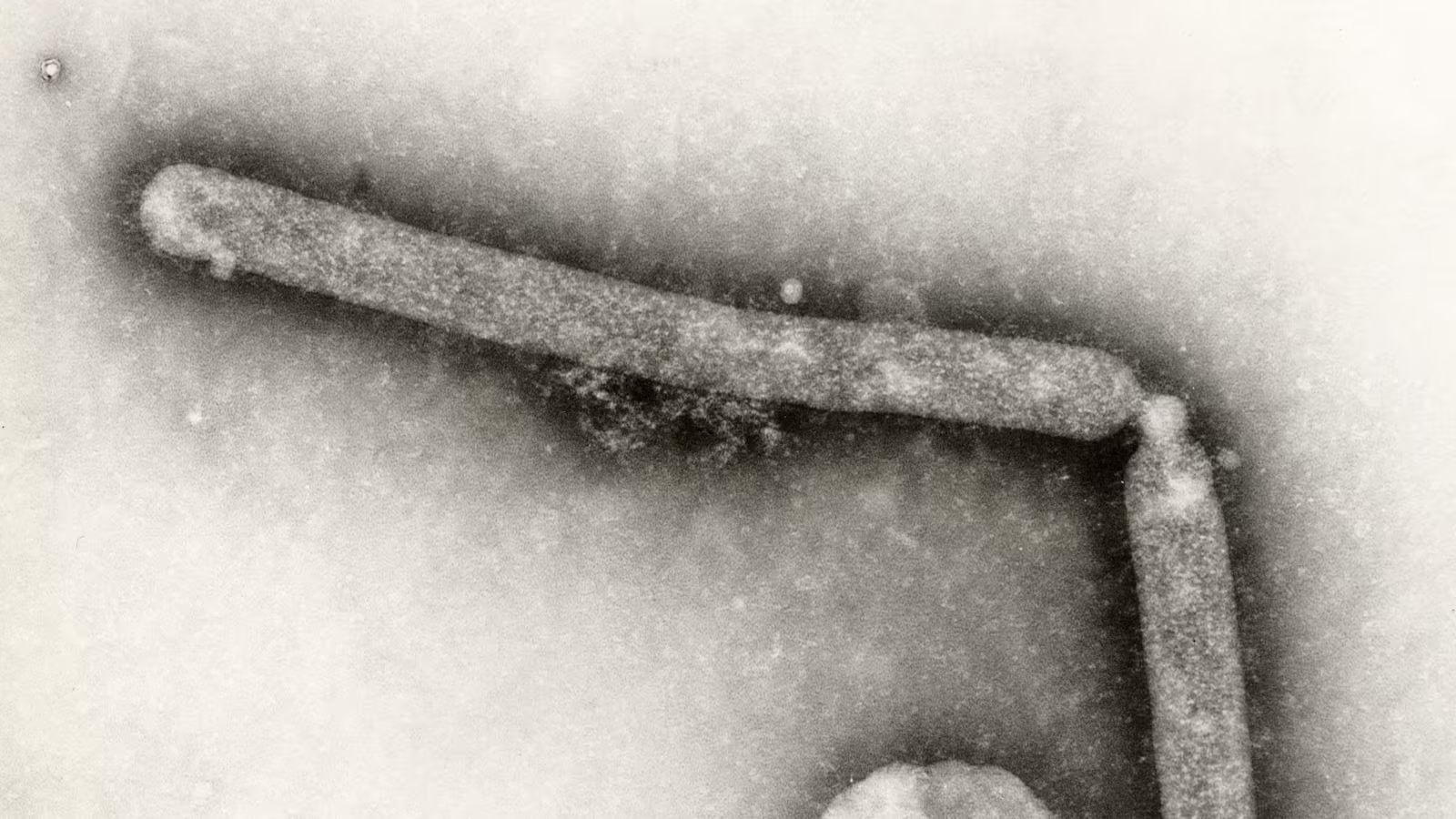 CDC detecta mutación del virus de la gripe aviar en paciente en EU