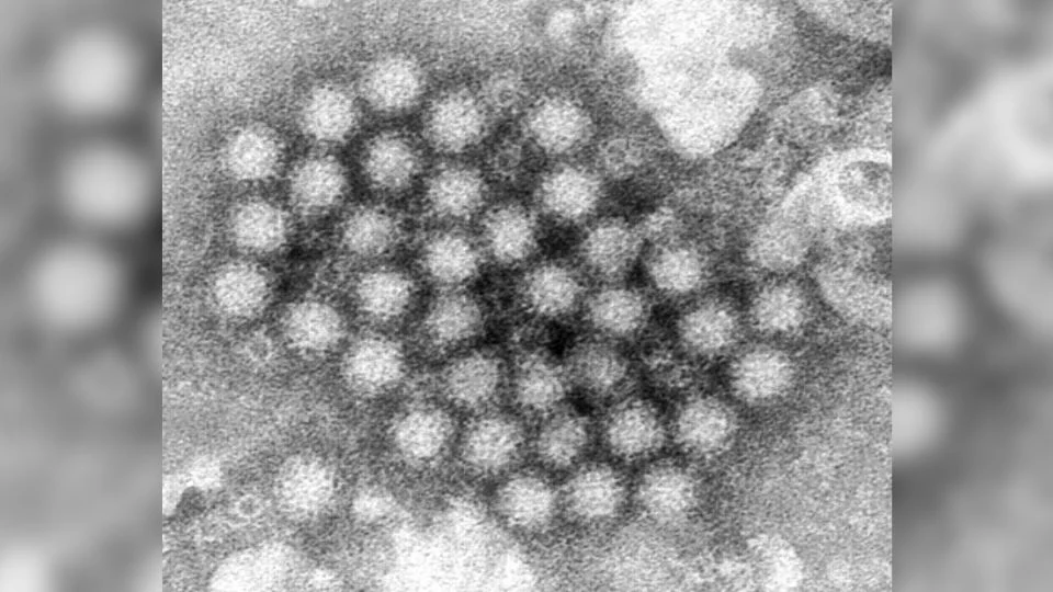 Aumentan en EU los brotes de un virus estomacal que causa vómitos y diarrea súbitos