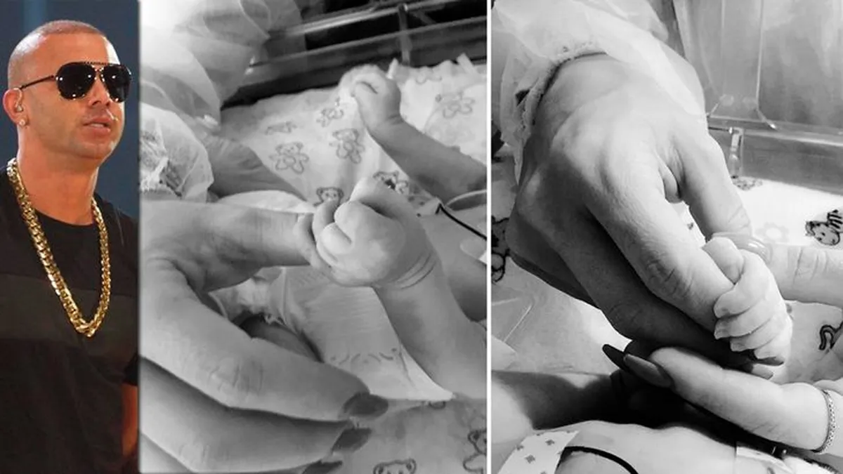 ¿Qué es el síndrome de Patau? Enfermedad que causó la muerte de la hija de Wisin