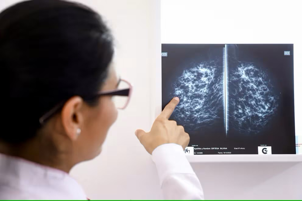 Aumenta el cáncer en adultos jóvenes: Estudio indica el posible motivo