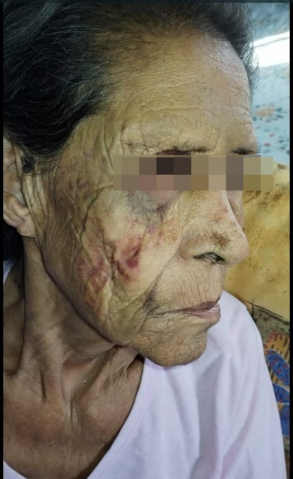 Da brutal golpiza hijo a ancianita