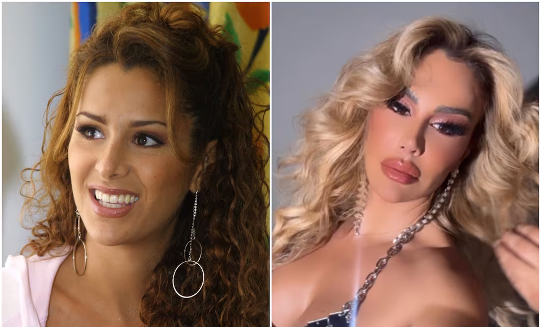 Ninel Conde presume labios voluptuosos y desata las críticas