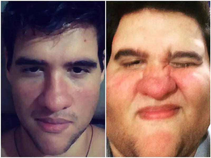 Murió Gabriel Freitas, influencer brasileño, tras su lucha contra la obesidad