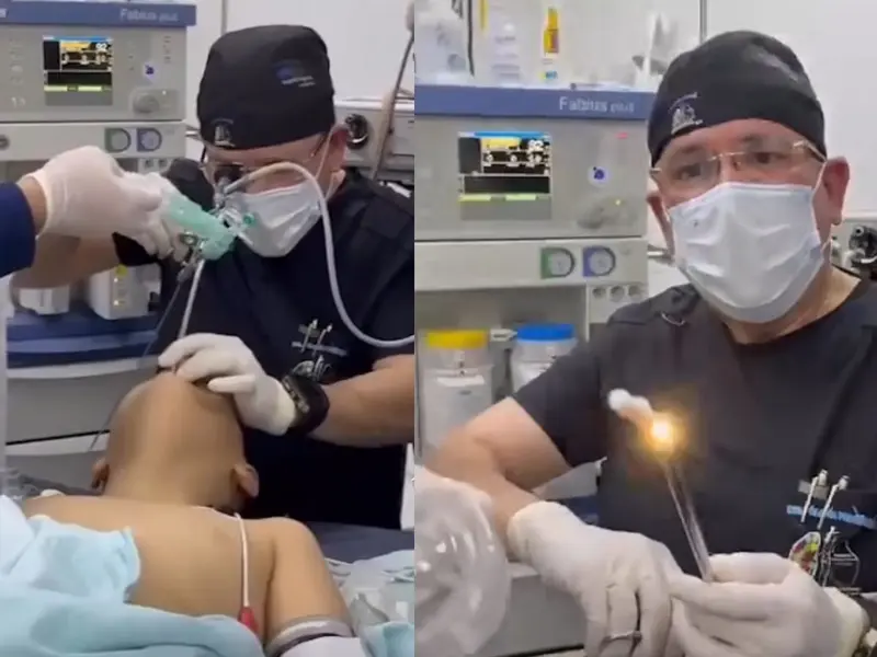 Paciente fue operado tras tragarse un muñeco de la Rosca de Reyes