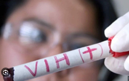 Suman 80 casos de VIH en este año