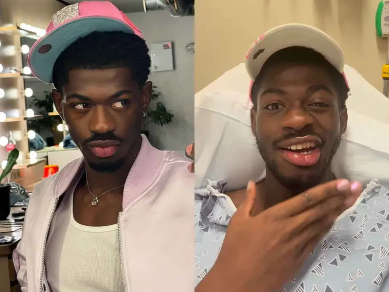 Lil Nas X es hospitalizado después de haber perdido el control del lado derecho de su cara