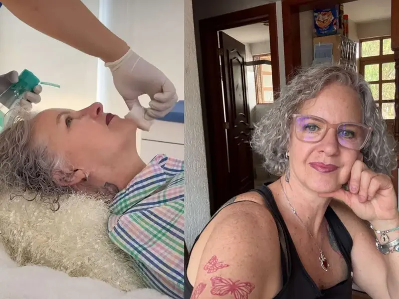Mamá de Gala Montes sorprende con su nuevo rostro tras tratamiento estético