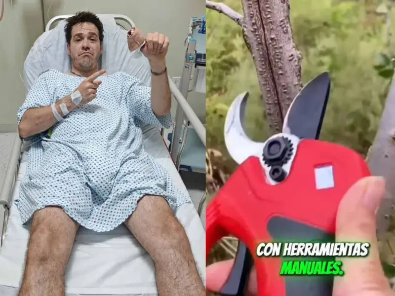  Jimmy de Pongámoslo a Prueba sufre grave accidente probando producto