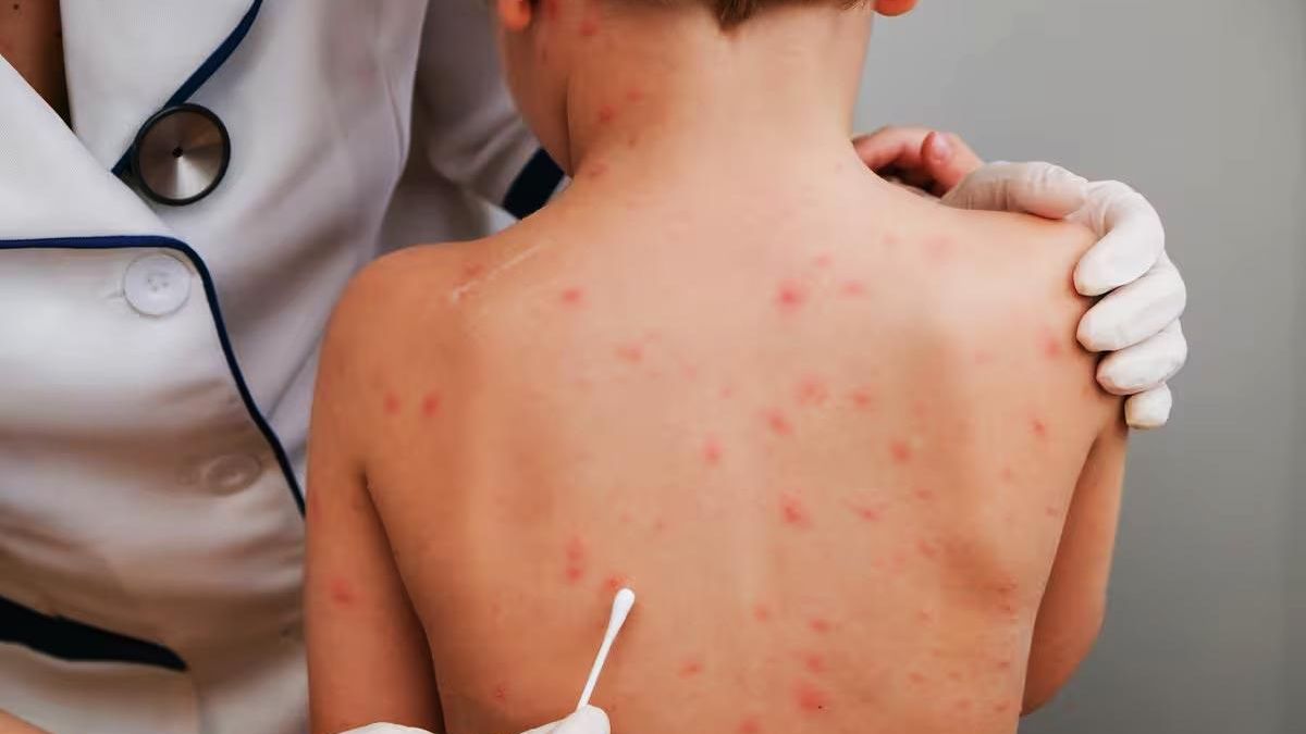 Grupos “antivacunas” son un riesgo a la salud pública