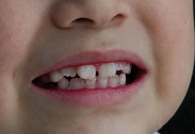 ¡Histórico avance! Científicos logran cu1tivar dientes humanos en laboratorio