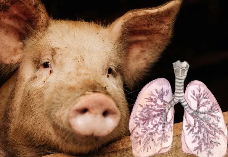 Realizan el primer trasplante de un pulmón de cerdo modificado genéticamente a una persona