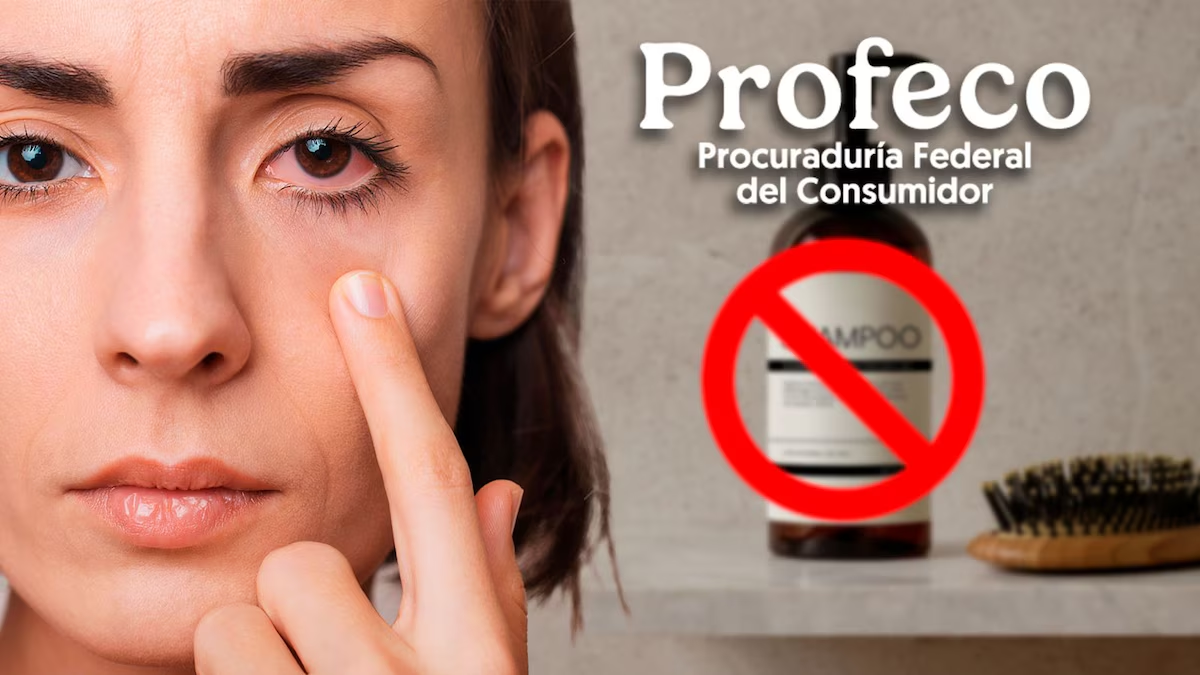 Profeco alerta sobre lote de champú posiblemente cont4minado con bacteria; ¿cuál es y cómo identificarlo?