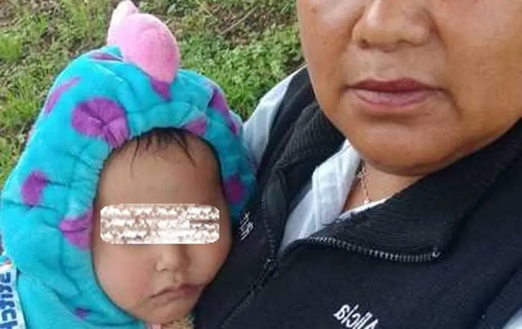 Bebé quemada en La Concordia, será trasladada a hospital en Texas