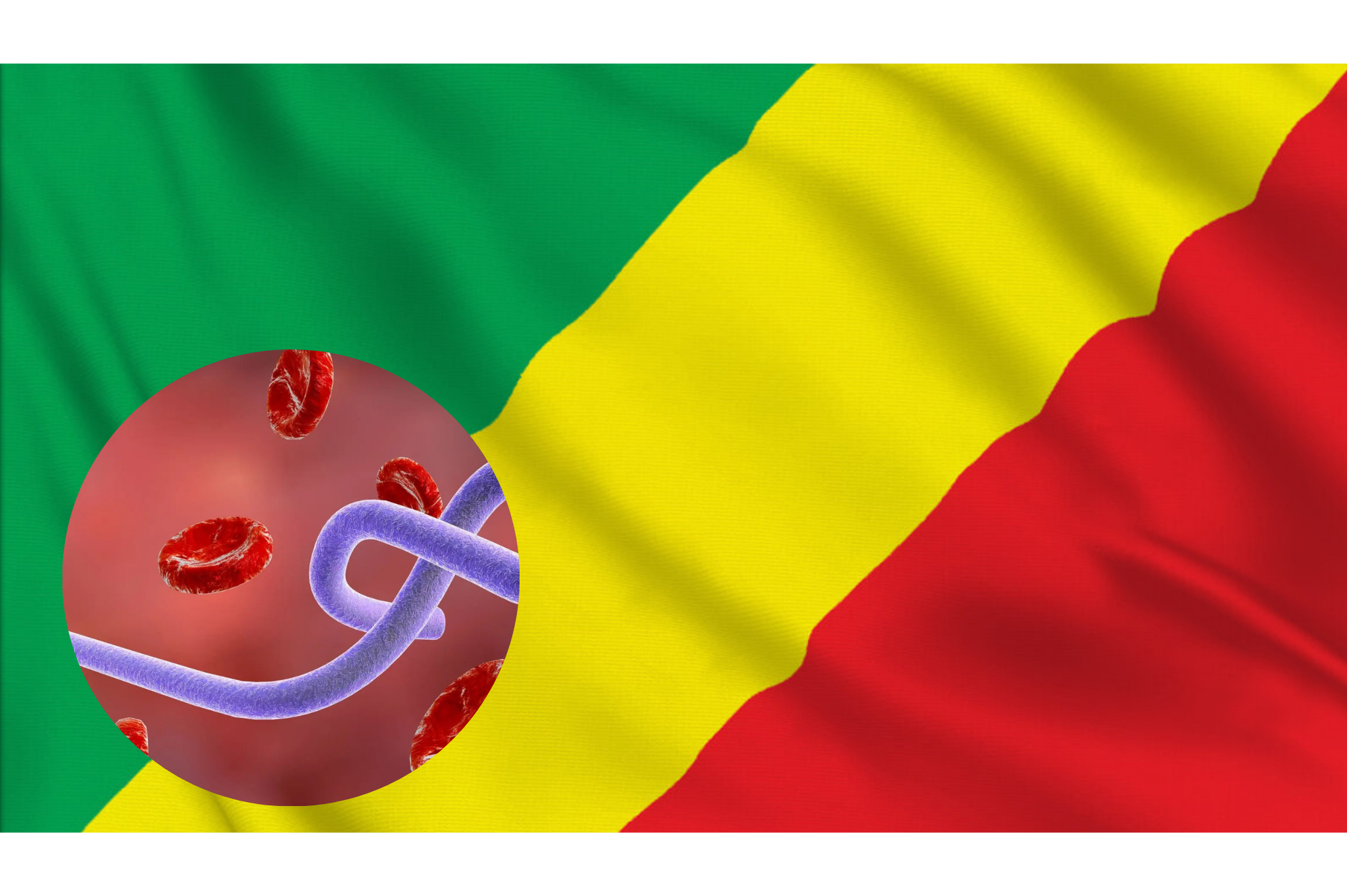 OMS alerta por nuevo brote de ébola en el Congo