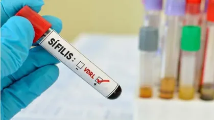 Alerta contagios de sífilis a bebés