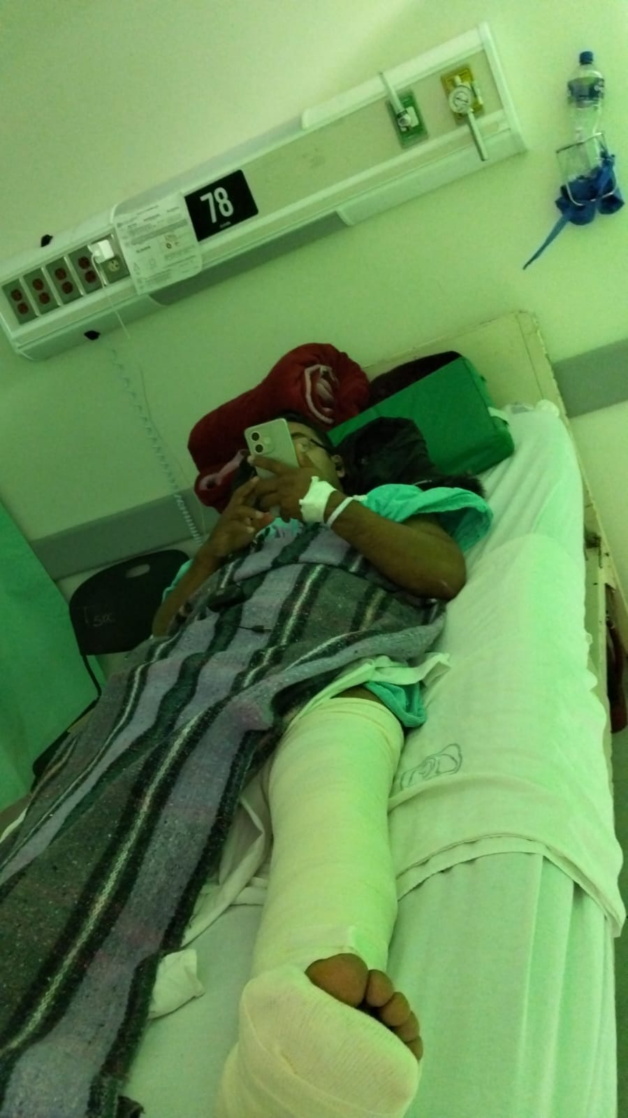 Deja IMSS a paciente con fractura expuesta