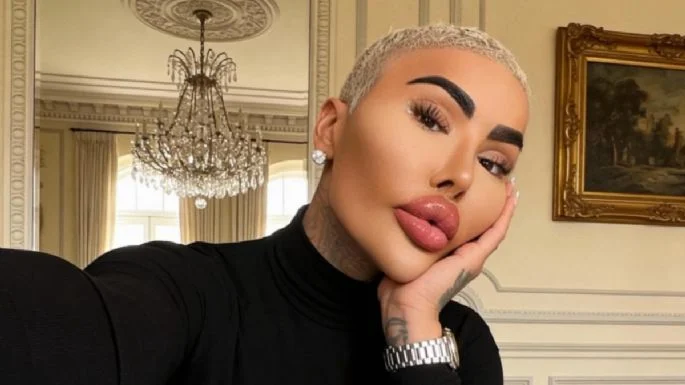 Fallece Jordan James Parke, influencer que gastó miles de dólares para parecerse a Kim Kardashian
