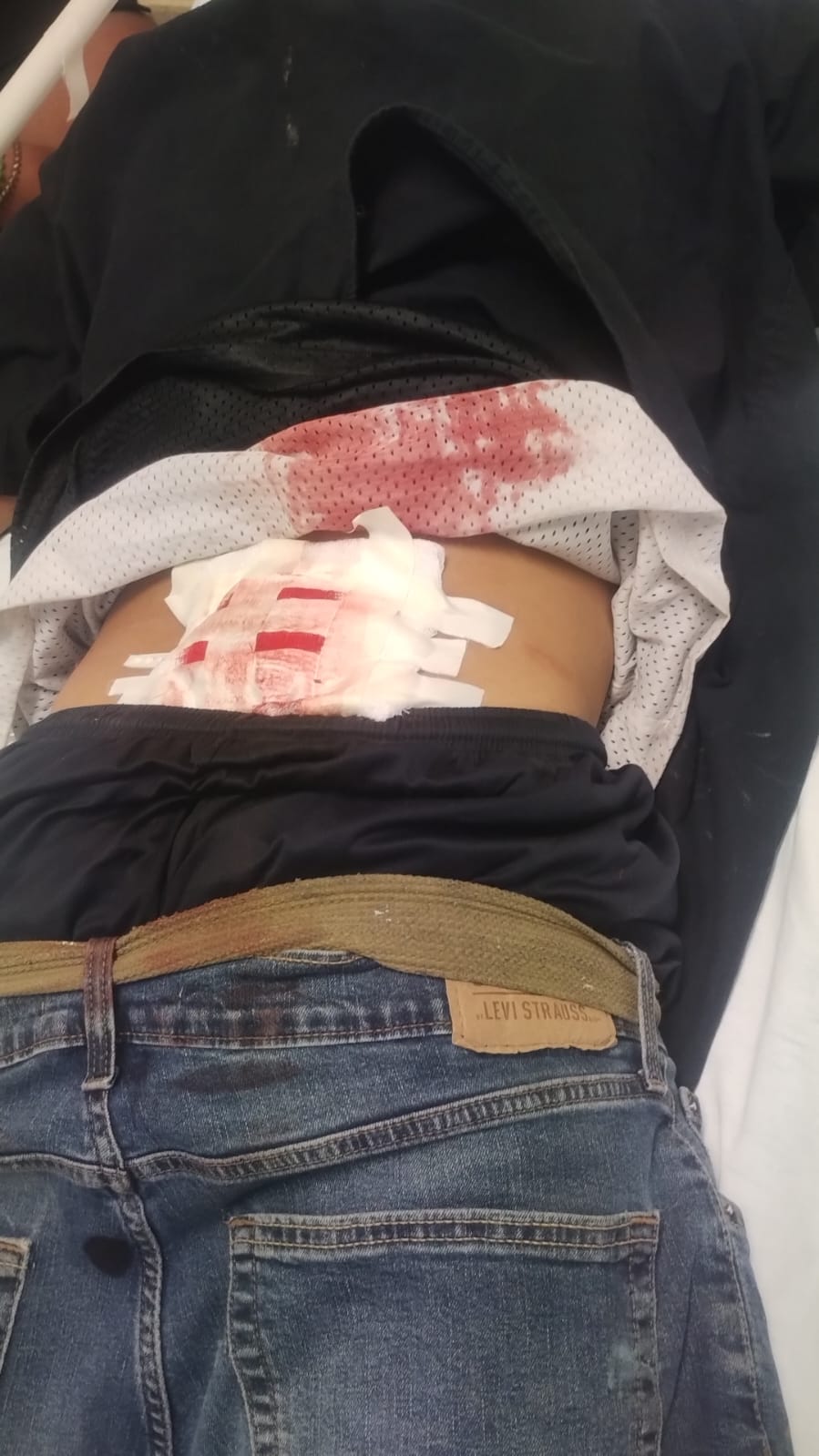 BRUTAL AGRESIÓN A JOVEN; SE METEN A SU VIVIENDA