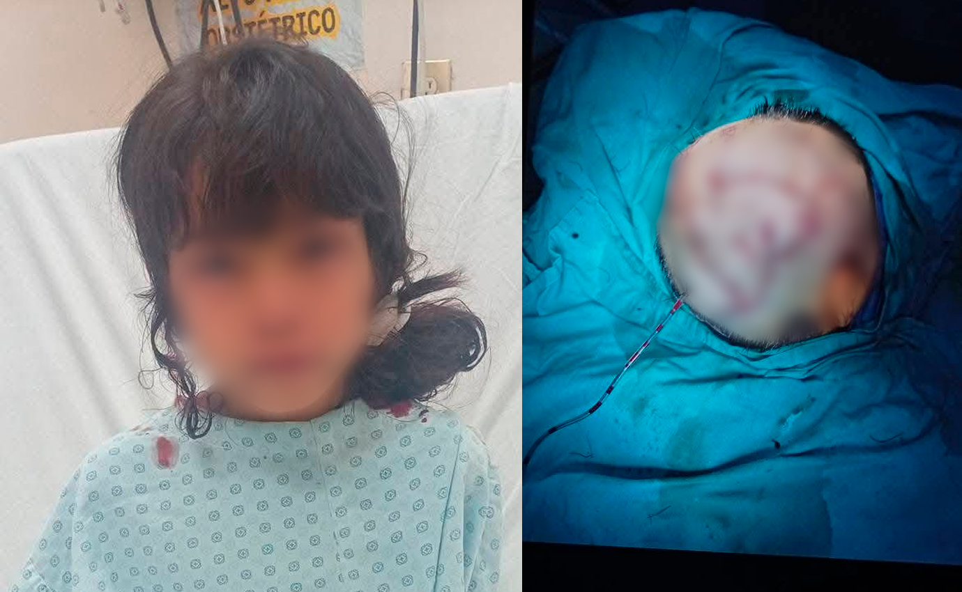 Un milagro de vida”: niña sobrevive a brutal ataque de perro