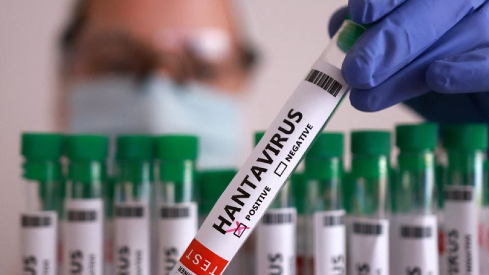 Hospitalizan en Ámsterdam a azafata con posibles síntomas de hantavirus tras contacto con una persona contagiada en el crucero