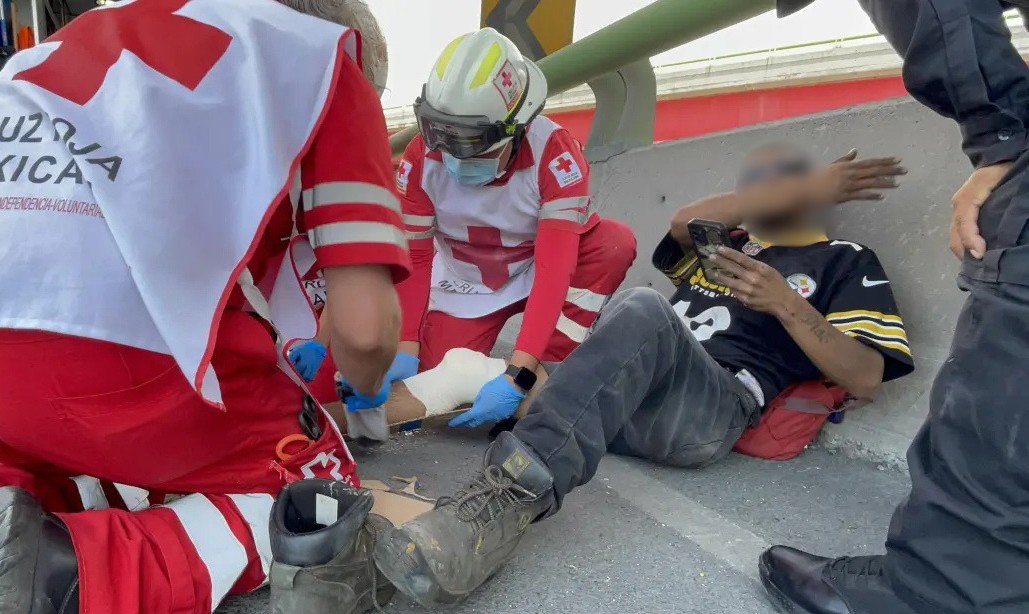 Derrapa motociclista y sufre fractura expuesta